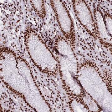 Anti-TMEM35B antibody produced in rabbit，100UL，HPA051024-100UL，Sigma