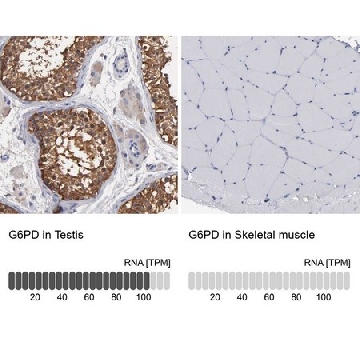 Anti-G6PD antibody produced in rabbit，100UL，HPA000834-100UL，Sigma