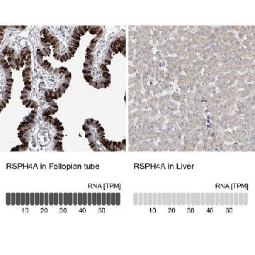 Anti-RSPH4A antibody produced in rabbit，100UL，HPA031198-100UL，Sigma