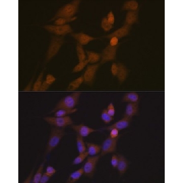 Anti-STK33 antibody produced in rabbit，100UL，SAB5701373-100UL，Sigma