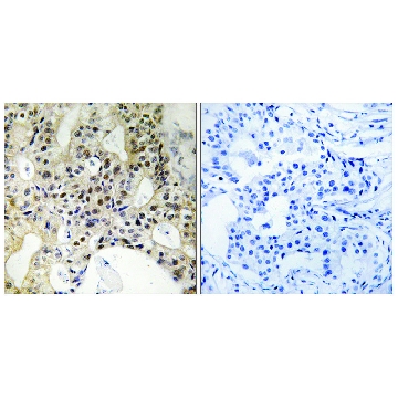 Anti-LATS1 antibody produced in rabbit，100UG，SAB4501145-100UG，Sigma