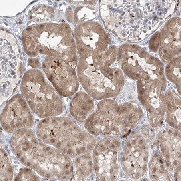 Anti-ZBTB48 antibody produced in rabbit，100UL，HPA030417-100UL，Sigma