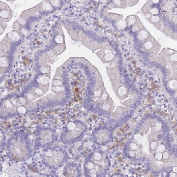 Anti-SSUH2 antibody produced in rabbit，100UL，HPA049777-100UL，Sigma