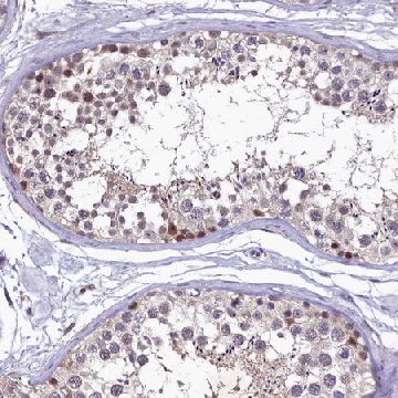 Anti-LATS2 antibody produced in rabbit，100UL，HPA039191-100UL，Sigma