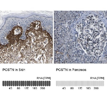 Anti-POSTN antibody produced in rabbit，100UL，HPA012306-100UL，Sigma