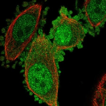 Anti-C19orf33 antibody produced in rabbit，100UL，HPA059696-100UL，Sigma