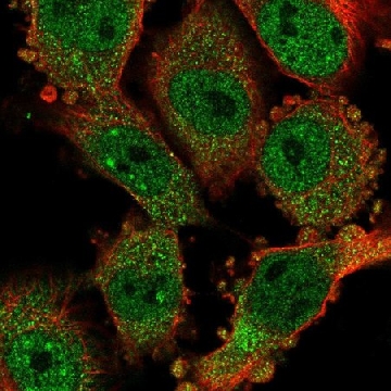 Anti-CCDC159 antibody produced in rabbit，100UL，HPA054655-100UL，Sigma