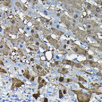Anti-Arginase 1 (ARG1) antibody produced in rabbit，100UL，SAB5701574-100UL，Sigma