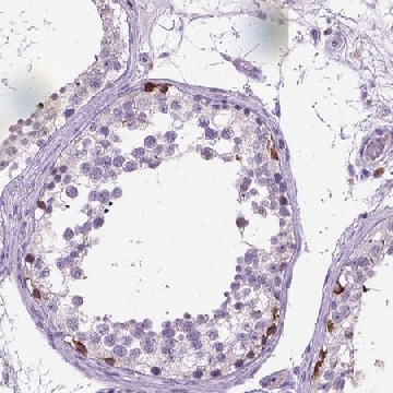 Anti-PLK4 antibody produced in rabbit，100UL，HPA043198-100UL，Sigma