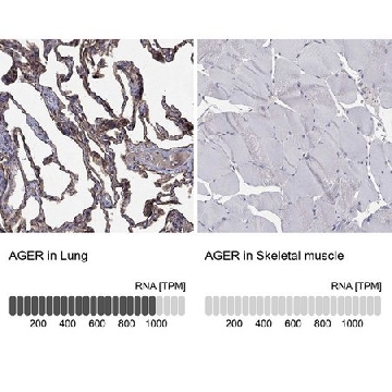 Anti-AGER antibody produced in rabbit，100UL，HPA069474-100UL，Sigma