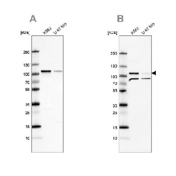 Anti-SRPK1 antibody produced in rabbit，100UL，HPA016431-100UL，Sigma