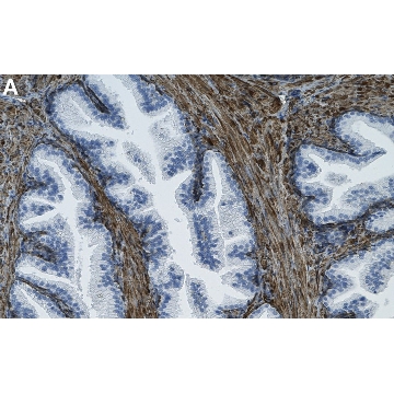 Anti-Filamin A Antibody, clone PM6/317 ZooMAb® Mouse Monoclonal，25UL，ZMS1175-25UL，Sigma
