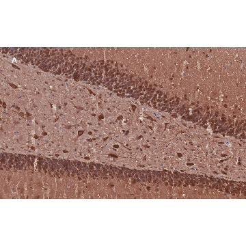 Anti-MAP2 Antibody, clone 3C19, ZooMAb® Rabbit Monoclonal，25UL，ZRB2290-25UL，Sigma