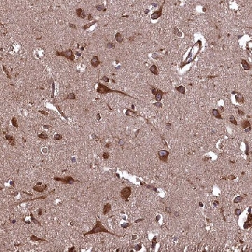 Anti-PLA2G4C antibody produced in rabbit，100UL，HPA043083-100UL，Sigma