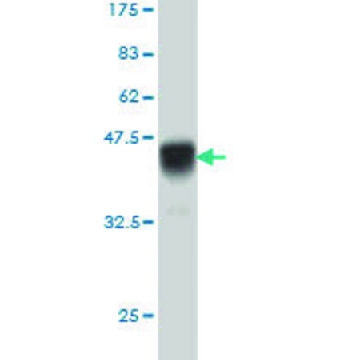 Monoclonal Anti-IL15RA antibody produced in mouse，100UG，WH0003601M1-100UG，Sigma