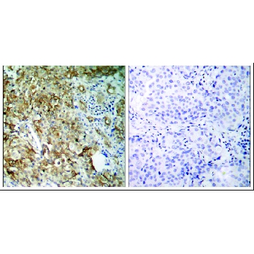 Anti-IGF1R (Ab-1161) antibody produced in rabbit，100UG，SAB4300359-100UG，Sigma