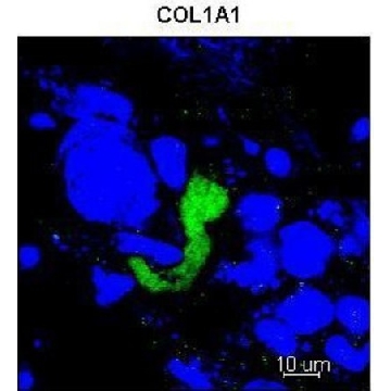 Anti-COL1A1 (C-terminal) antibody produced in rabbit，100UL，SAB2109131-100UL，Sigma