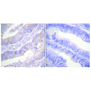 Anti-CFTR antibody produced in rabbit，100UG，SAB4501942-100UG，Sigma