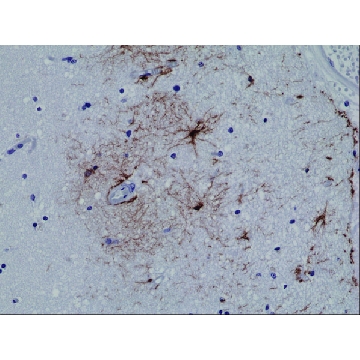 Anti-GFAP antibody, Rabbit monoclonal，100UL，SAB5600060-100UL，Sigma