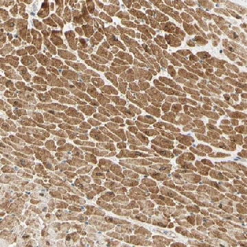 Anti-ADAM17 antibody produced in rabbit，100UL，HPA010738-100UL，Sigma