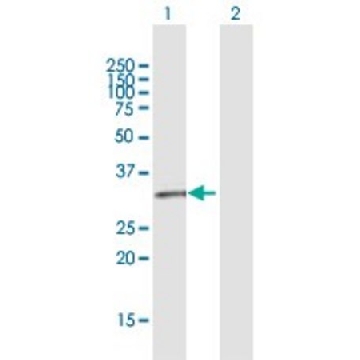 Anti-GPR146 antibody produced in rabbit，100UG，SAB1408697-100UG，Sigma