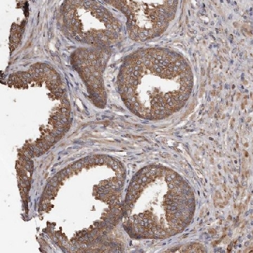 Anti-STEAP2 antibody produced in rabbit，100UL，HPA029115-100UL，Sigma