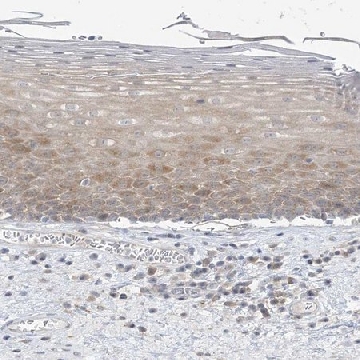 Anti-THADA antibody produced in rabbit，100UL，HPA035192-100UL，Sigma
