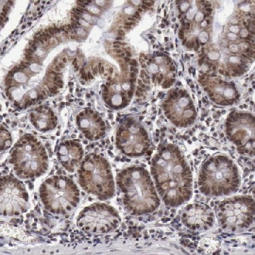 Anti-VRTN antibody produced in rabbit，100UL，HPA001460-100UL，Sigma