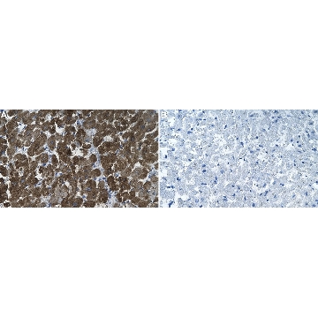 Anti-Laminin α2 80 kDa Antibody, clone 5H2 ZooMAb® Mouse Monoclonal，4X25UL，ZMS1120-4X25UL，Sigma