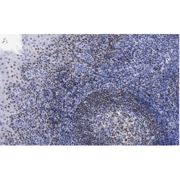 Anti-Bcl11A Antibody, clone 2C4 ZooMAb® Rabbit Monoclonal，4X25UL，ZRB1518-4X25UL，Sigma