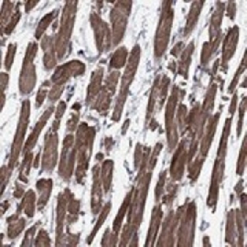 Anti-SCN7A antibody produced in rabbit，100UL，HPA072715-100UL，Sigma