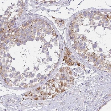 Anti-TMEM219 antibody produced in rabbit，100UL，HPA059185-100UL，Sigma