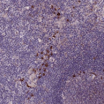 Anti-LTB antibody produced in rabbit，100UL，HPA048884-100UL，Sigma