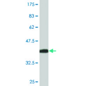 Monoclonal Anti-CH25H antibody produced in mouse，100UG，SAB1403010-100UG，Sigma