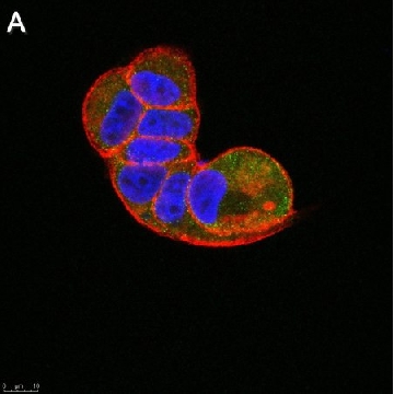 Anti-TSG101 Antibody, clone 2H18 ZooMAb® Rabbit Monoclonal，25UL，ZRB1244-25UL，Sigma