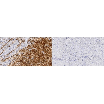 Anti-Dopamine Transporter Antibody, clone 1D2 ZooMAb® Rabbit Monoclonal，25UL，ZRB1525-25UL，Sigma