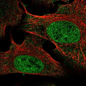Anti-SETDB2 antibody produced in rabbit，100UL，HPA071677-100UL，Sigma