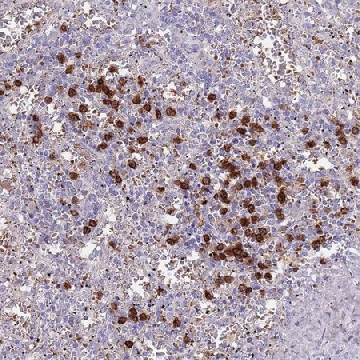 Anti-TMEM251 antibody produced in rabbit，100UL，HPA048559-100UL，Sigma