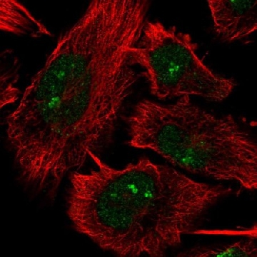 Anti-DHX33 antibody produced in rabbit，100UL，HPA073875-100UL，Sigma