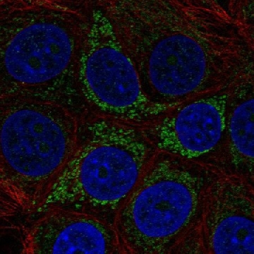 Anti-A4GALT antibody produced in rabbit，100UL，HPA001141-100UL，Sigma