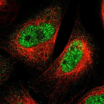 Anti-SPRTN antibody produced in rabbit，100UL，HPA025073-100UL，Sigma