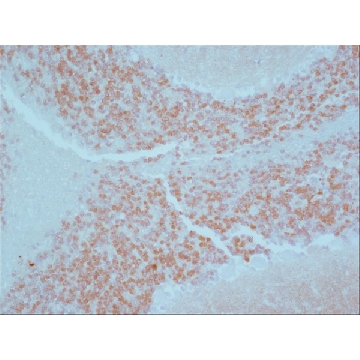 Anti-Calretinin antibody produced in rabbit，0.2ML，C7479-.2ML，Sigma