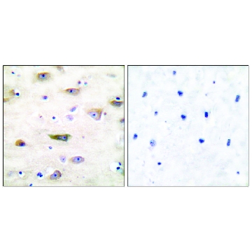 Anti-GLUR2 antibody produced in rabbit，100UG，SAB4501295-100UG，Sigma