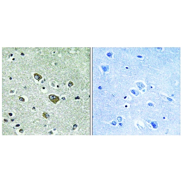 Anti-ZDHHC9 antibody produced in rabbit，100UG，SAB4502104-100UG，Sigma