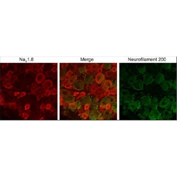 Anti-Sodium Channel NaV1.8 antibody produced in rabbit，50UL，S2071-50UL，Sigma