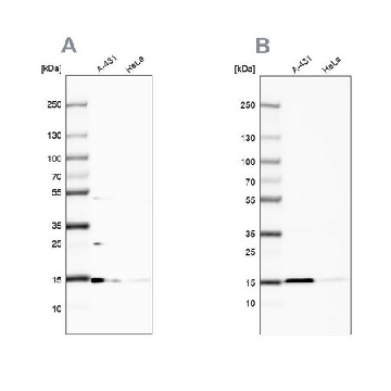 Anti-CCDC58 antibody produced in rabbit，100UL，HPA051965-100UL，Sigma