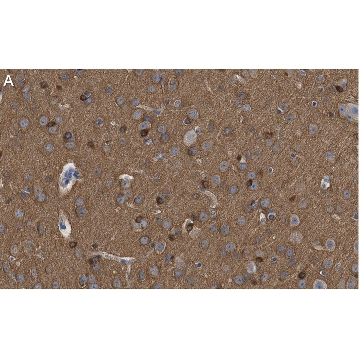 Anti-Tau-1 Antibody, clone PC1C6 ZooMAb® Mouse Monoclonal，4X25UL，ZMS3420-4X25UL，Sigma