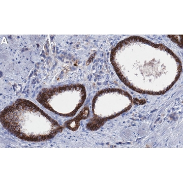 Anti-CXADR/CAR Antibody, clone 1D19 ZooMAb® Rabbit Monoclonal，4X25UL，ZRB1749-4X25UL，Sigma