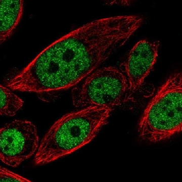 Anti-CYHR1 antibody produced in rabbit，100UL，HPA059543-100UL，Sigma