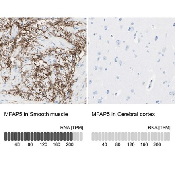 Anti-MFAP5 antibody produced in rabbit，100UL，HPA010553-100UL，Sigma